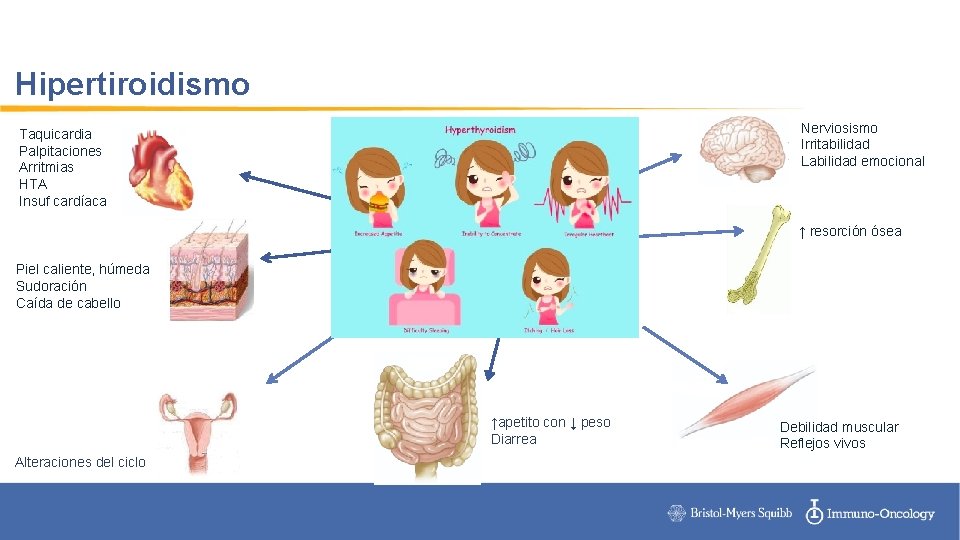 Hipertiroidismo Nerviosismo Irritabilidad Labilidad emocional Taquicardia Palpitaciones Arritmias HTA Insuf cardíaca ↑ resorción ósea