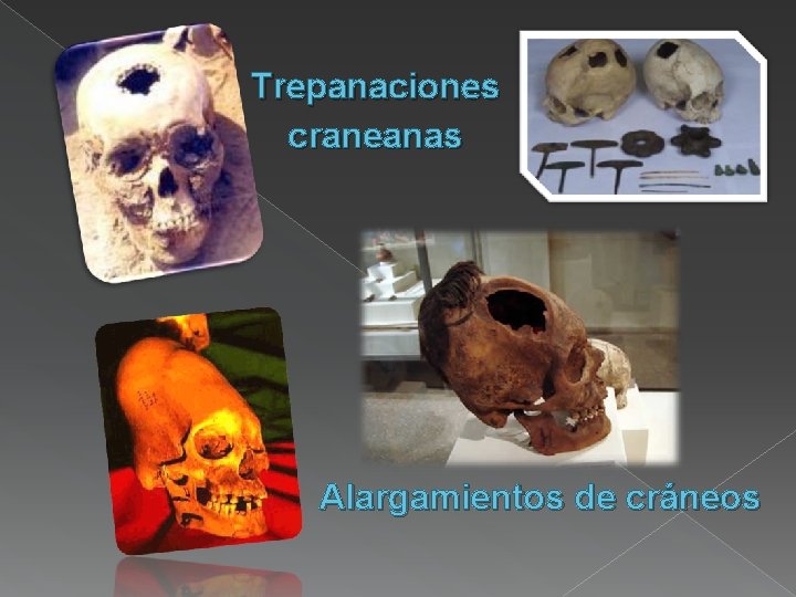 Trepanaciones craneanas Alargamientos de cráneos 