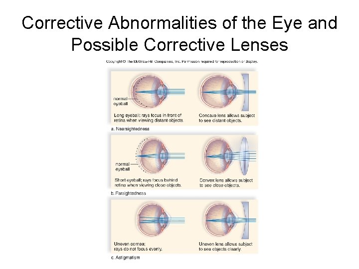 Corrective Abnormalities of the Eye and Possible Corrective Lenses 