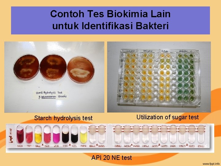 Contoh Tes Biokimia Lain untuk Identifikasi Bakteri Starch hydrolysis test API 20 NE test