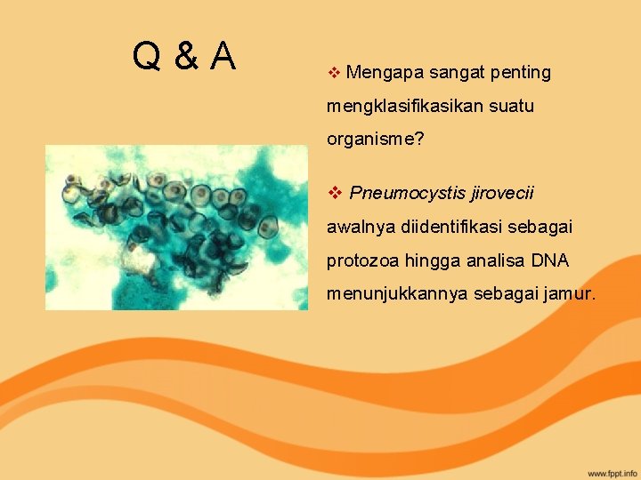 Q & A v Mengapa sangat penting mengklasifikasikan suatu organisme? v Pneumocystis jirovecii awalnya