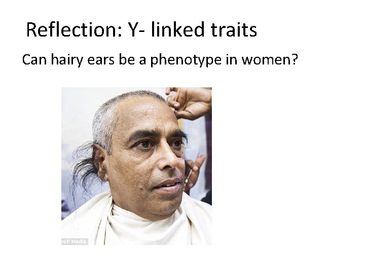 Reflection: Y- linked traits Can hairy ears be a phenotype in women? 