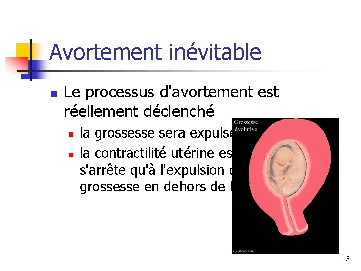 Avortement inévitable n Le processus d'avortement est réellement déclenché n n la grossesse sera