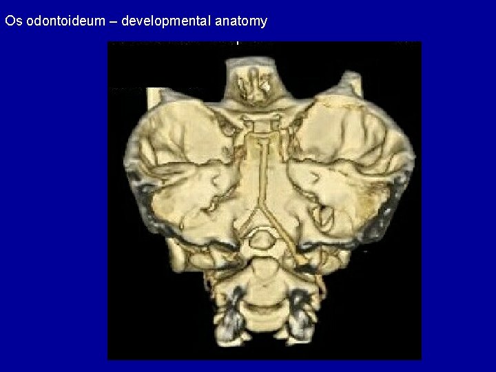 Os odontoideum – developmental anatomy 