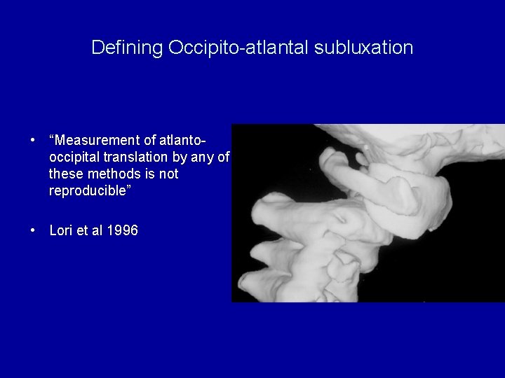 Defining Occipito-atlantal subluxation • “Measurement of atlantooccipital translation by any of these methods is