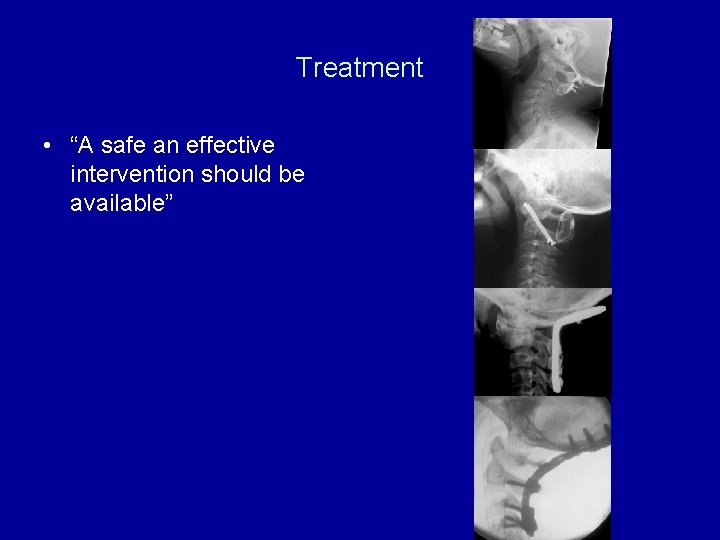 Treatment • “A safe an effective intervention should be available” 