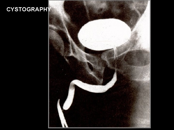 CYSTOGRAPHY 