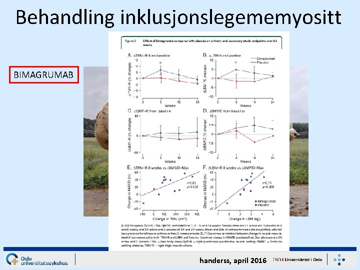 Behandling inklusjonslegememyositt BIMAGRUMAB handerss, april 2016 