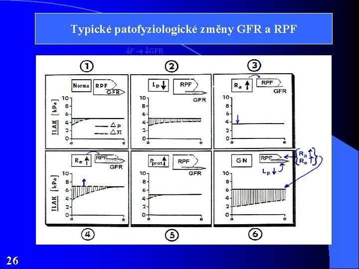 Typické patofyziologické změny GFR a RPF F GFR 26 