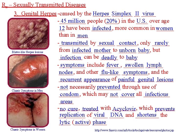 Rx – Sexually Transmitted Diseases 3. Genital Herpes -caused by the Herpes ______ Simplex