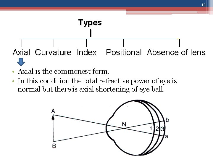 11 Types | | | Axial Curvature Index Positional Absence of lens • Axial