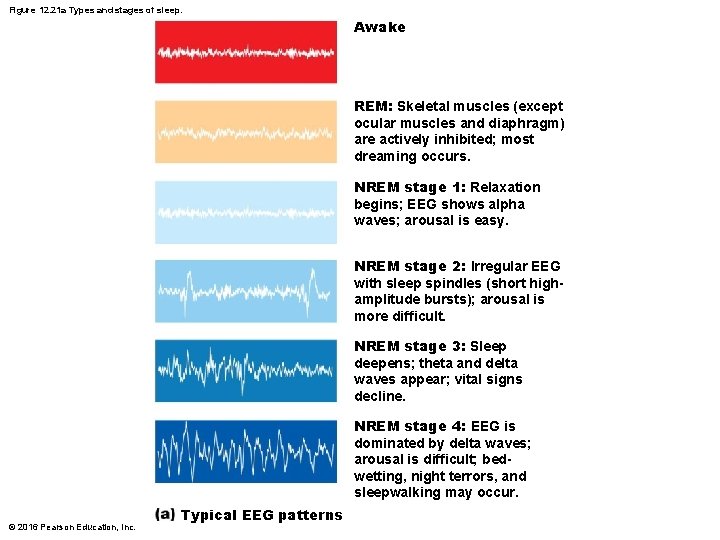 Figure 12. 21 a Types and stages of sleep. Awake REM: Skeletal muscles (except Figure 12. 21 a Types and stages of sleep. Awake REM: Skeletal muscles (except