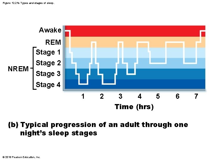 Figure 12. 21 b Types and stages of sleep. Awake REM Stage 1 NREM Figure 12. 21 b Types and stages of sleep. Awake REM Stage 1 NREM