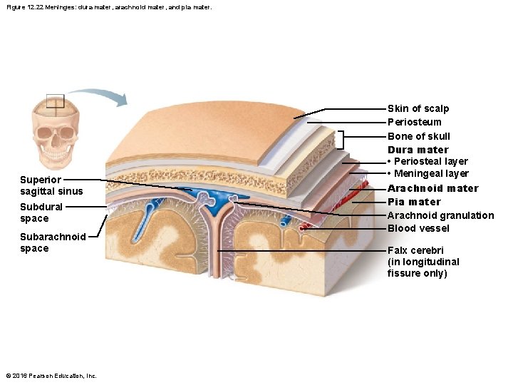Figure 12. 22 Meninges: dura mater, arachnoid mater, and pia mater. Superior sagittal sinus Figure 12. 22 Meninges: dura mater, arachnoid mater, and pia mater. Superior sagittal sinus