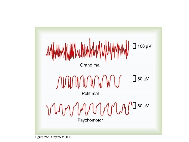 EEG Activity During Epilepsy Figure 59 -5; Guyton & Hall 