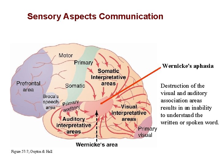 Sensory Aspects Communication Wernicke's aphasia Destruction of the visual and auditory association areas results