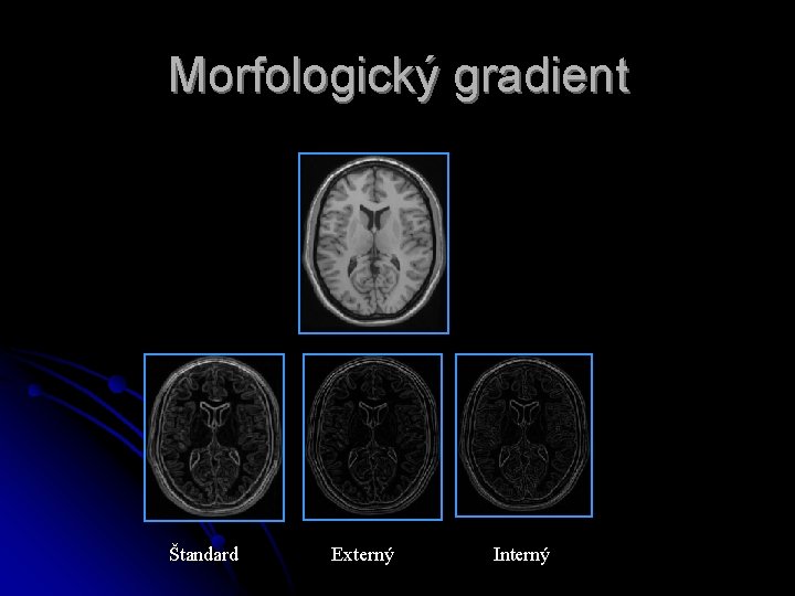 Morfologický gradient Štandard Externý Interný Morfologický gradient Štandard Externý Interný