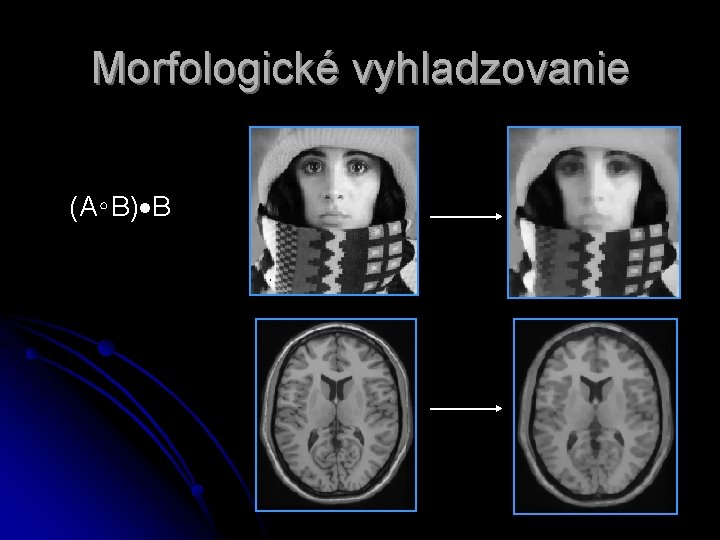 Morfologické vyhladzovanie (A∘B) B 