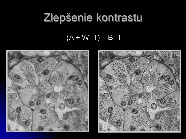 Zlepšenie kontrastu (A + WTT) – BTT 