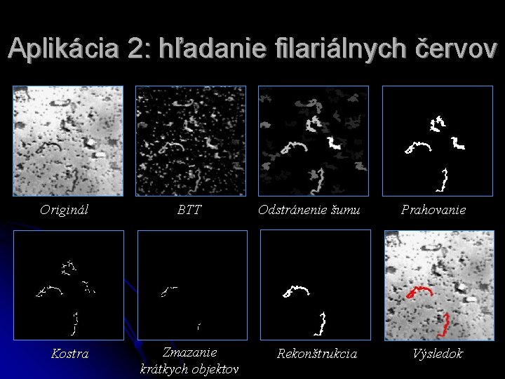 Aplikácia 2: hľadanie filariálnych červov Originál Kostra BTT Zmazanie krátkych objektov Odstránenie šumu Prahovanie