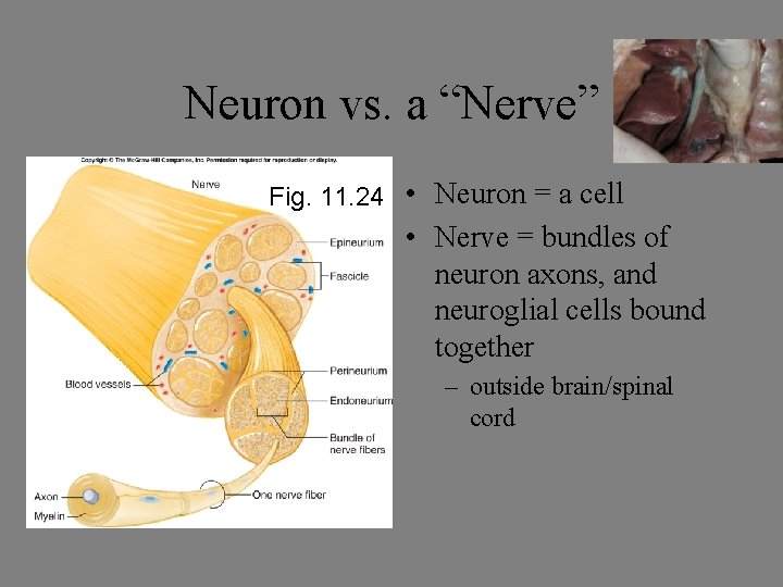 Neuron vs. a “Nerve” Fig. 11. 24 • Neuron = a cell • Nerve