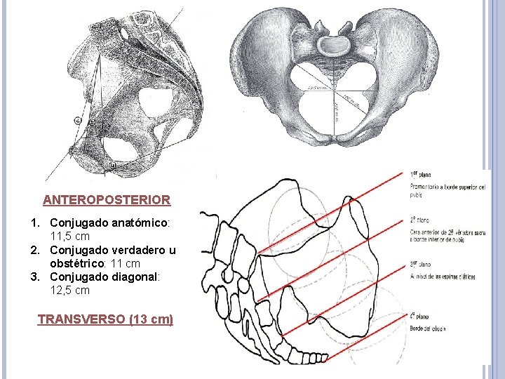 ANTEROPOSTERIOR 1. Conjugado anatómico: 11, 5 cm 2. Conjugado verdadero u obstétrico: 11 cm