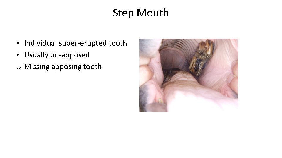 Step Mouth • Individual super-erupted tooth • Usually un-apposed o Missing apposing tooth 