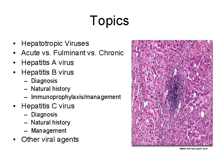 Topics • • Hepatotropic Viruses Acute vs. Fulminant vs. Chronic Hepatitis A virus Hepatitis