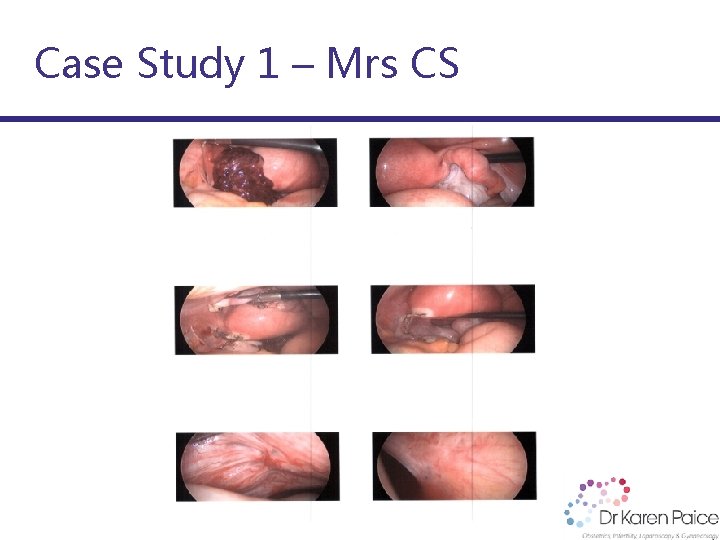 Case Study 1 – Mrs CS 