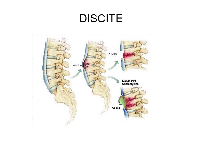 DISCITE 