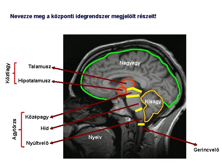 Köztiagy Nevezze meg a központi idegrendszer megjelölt részeit! Nagyagy Talamusz Hipotalamusz Agytörzs Kisagy Középagy