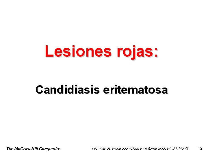Lesiones rojas: Candidiasis eritematosa The Mc. Graw-Hill Companies Técnicas de ayuda odontológica y estomatológica