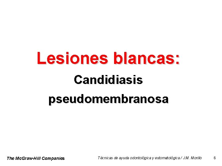 Lesiones blancas: Candidiasis pseudomembranosa The Mc. Graw-Hill Companies Técnicas de ayuda odontológica y estomatológica