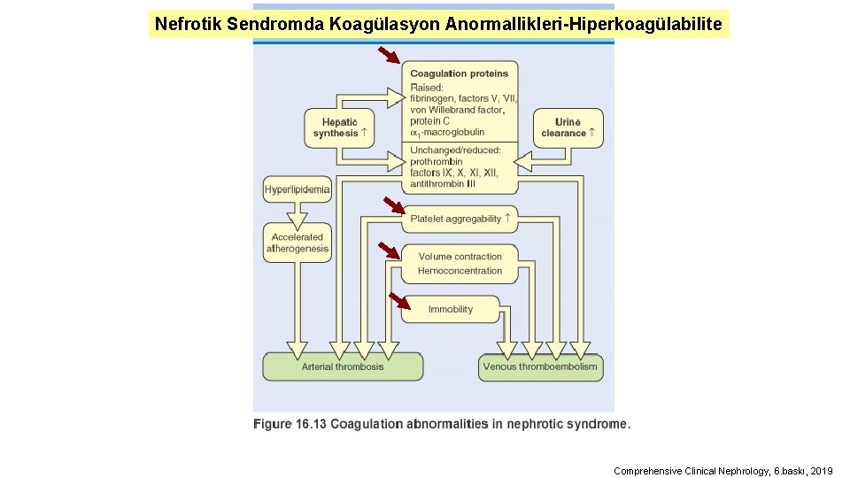Nefrotik Sendromda Koagülasyon Anormallikleri-Hiperkoagülabilite Comprehensive Clinical Nephrology, 6. baskı, 2019 
