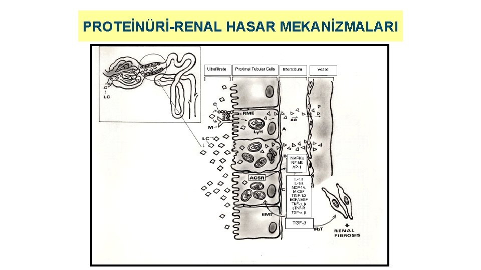 PROTEİNÜRİ-RENAL HASAR MEKANİZMALARI 