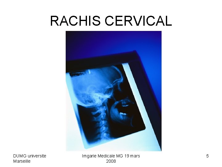 RACHIS CERVICAL DUMG universite Marseille Imgarie Medicale MG 19 mars 2008 5 