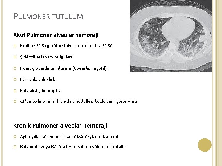 PULMONER TUTULUM Akut Pulmoner alveolar hemoraji Nadir (< % 5) görülür; fakat mortalite hızı
