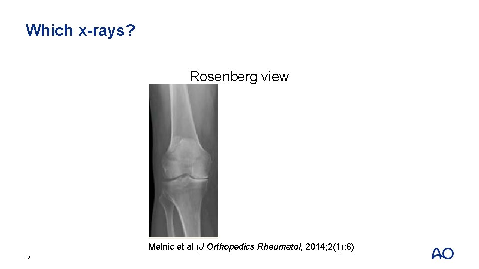 Which x-rays? Rosenberg view Melnic et al (J Orthopedics Rheumatol, 2014; 2(1): 6) 10
