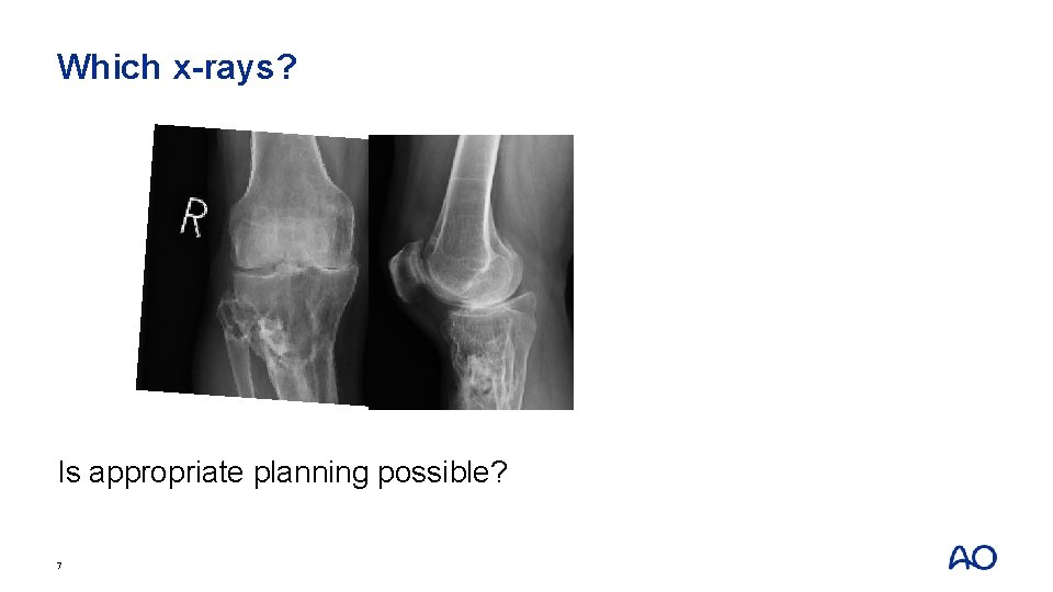 Which x-rays? Is appropriate planning possible? 7 