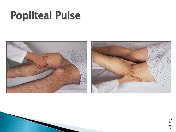 Popliteal Pulse Sli de 20 -8 