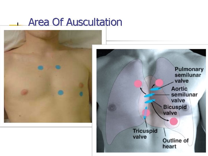 Area Of Auscultation 