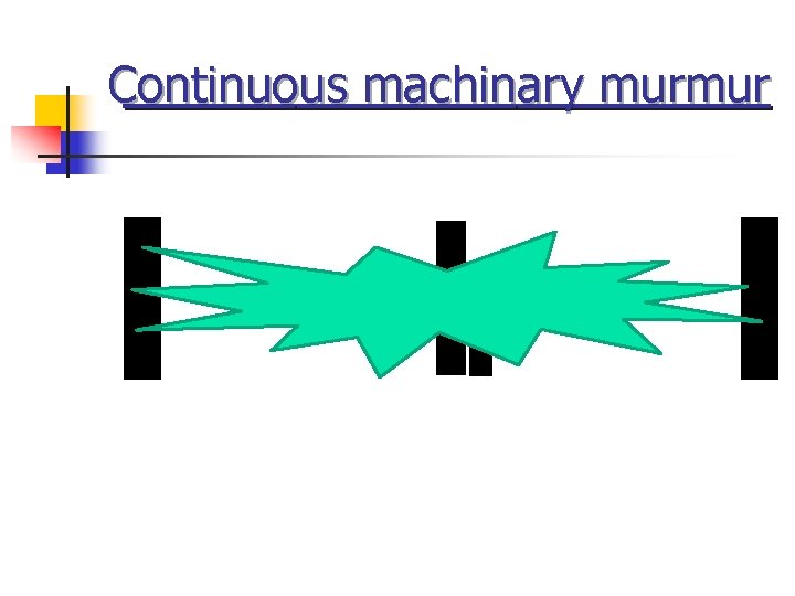 Continuous machinary murmur 