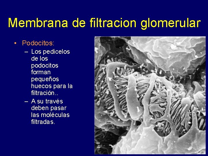 Membrana de filtracion glomerular • Podocitos: – Los pedicelos de los podocitos forman pequeños