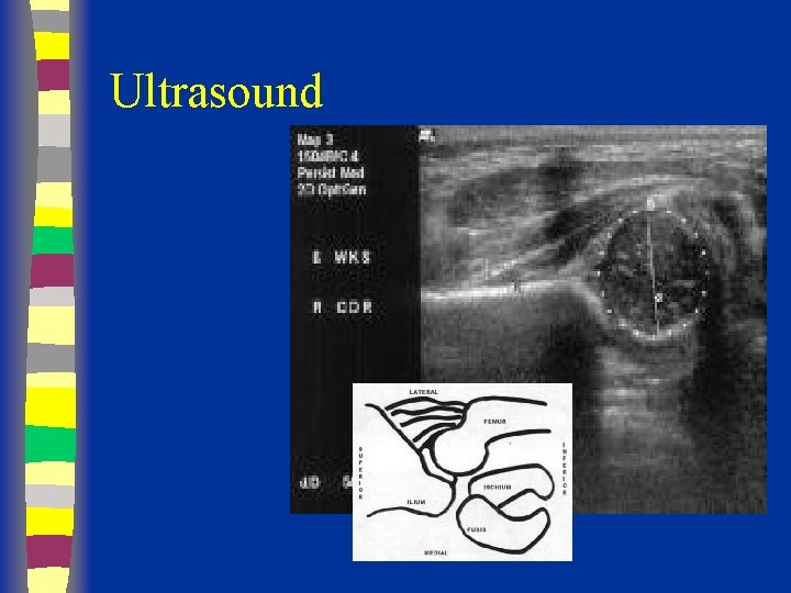 Ultrasound 