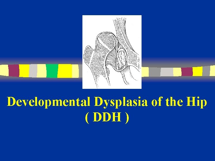 Developmental Dysplasia of the Hip ( DDH ) 