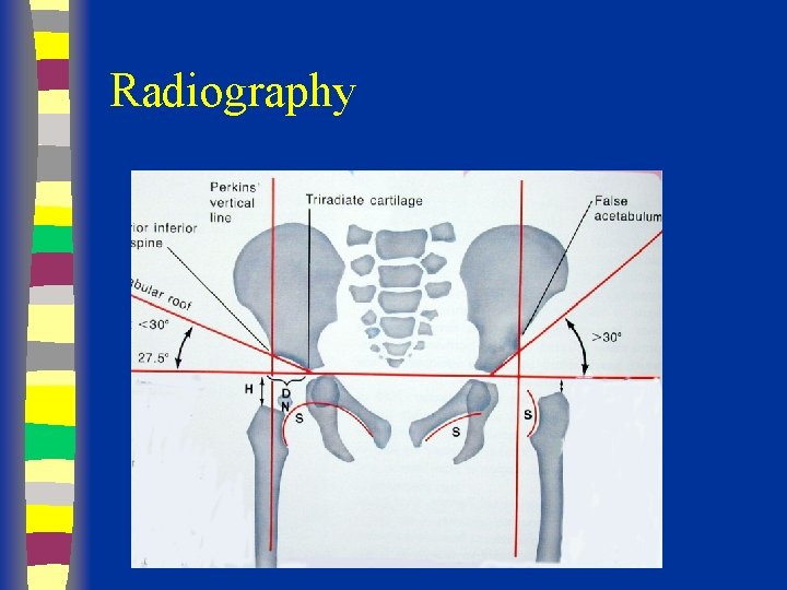 Radiography 