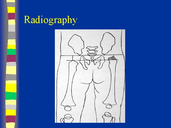 Radiography in out 