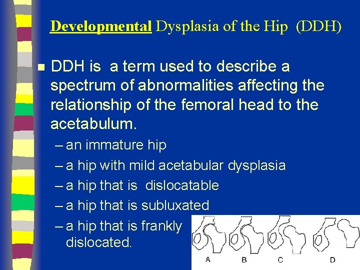 Developmental Dysplasia of the Hip (DDH) n DDH is a term used to describe