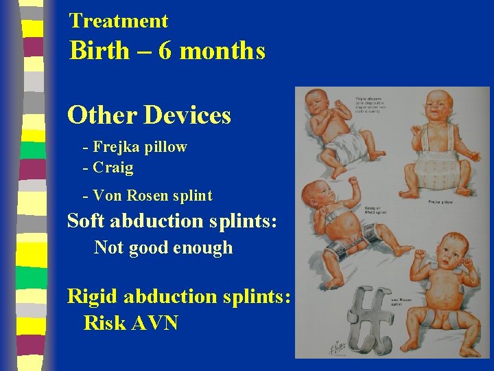 Treatment Birth – 6 months Other Devices - Frejka pillow - Craig - Von