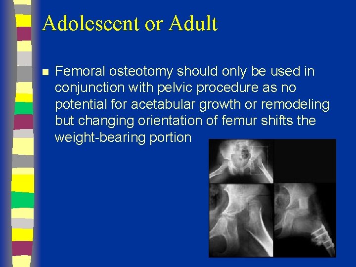 Adolescent or Adult n Femoral osteotomy should only be used in conjunction with pelvic